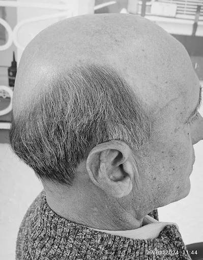 Antes — corte cliente 2