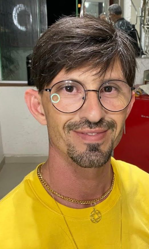 Depois — prótese capilar cliente 1