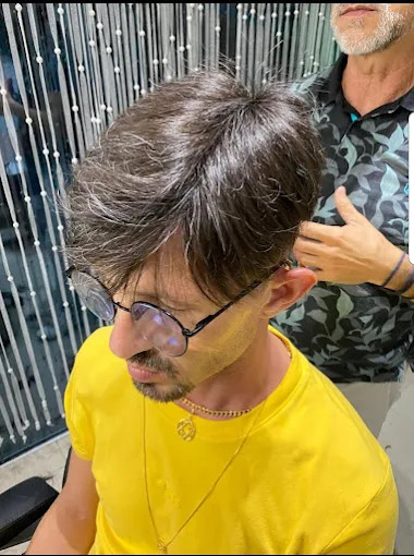 Depois — prótese capilar cliente 3