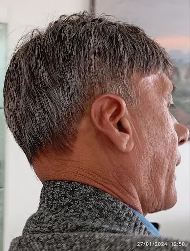 Depois — corte cliente 2